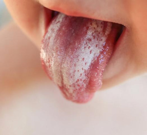 Bebeklerde Pamukçuk Nedir, Nasıl Geçer? - Mustela Türkiye - 1