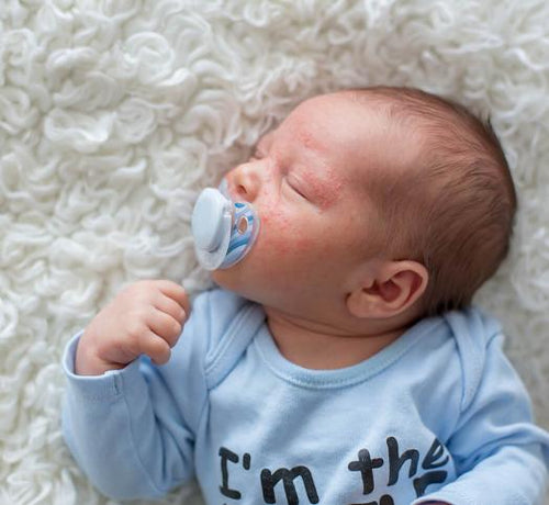 BEBEK_AKNESI_1048X964_67094f40-25f5-4958-9f59-9d4eb5ebc2b9 - Mustela Türkiye - 1