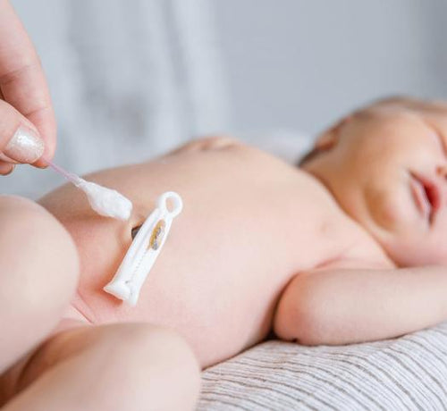 Göbek Bağı Bakımı Nasıl Olmalıdır? - Mustela Türkiye - 1