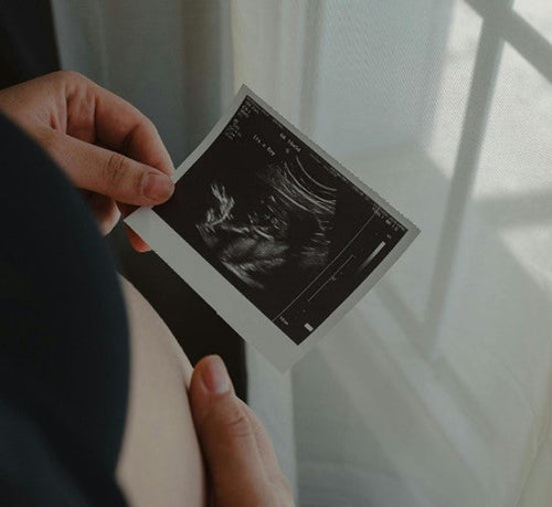 Hamileliğin Üçüncü Ayında Sizi ve Bebeğinizi Neler Bekliyor? - Mustela Türkiye - 1