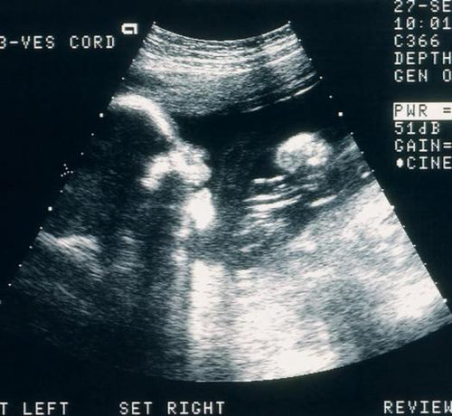 Sigarasız bir hamilelik için tavsiyeler - Mustela Türkiye - 1