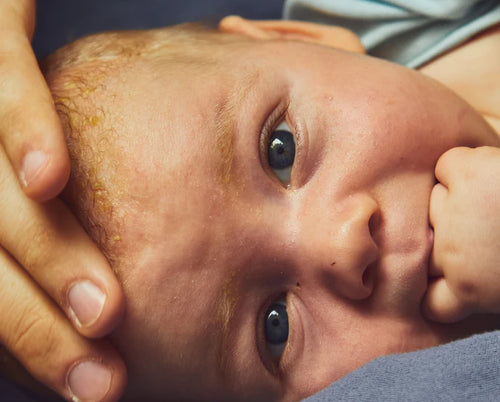 soins-nouveau-ne-mustela - Mustela Türkiye - 1